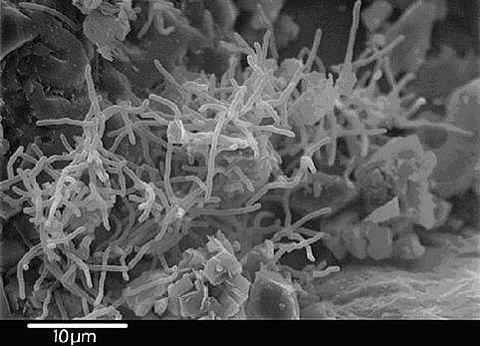 Bacteria in the pore space of a NBCU sandstone growing in response to feeding during the MPPM procedure